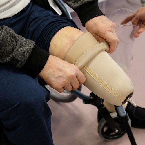 Chaussage d’une prothèse fémorale : la technique du parachute expliquée